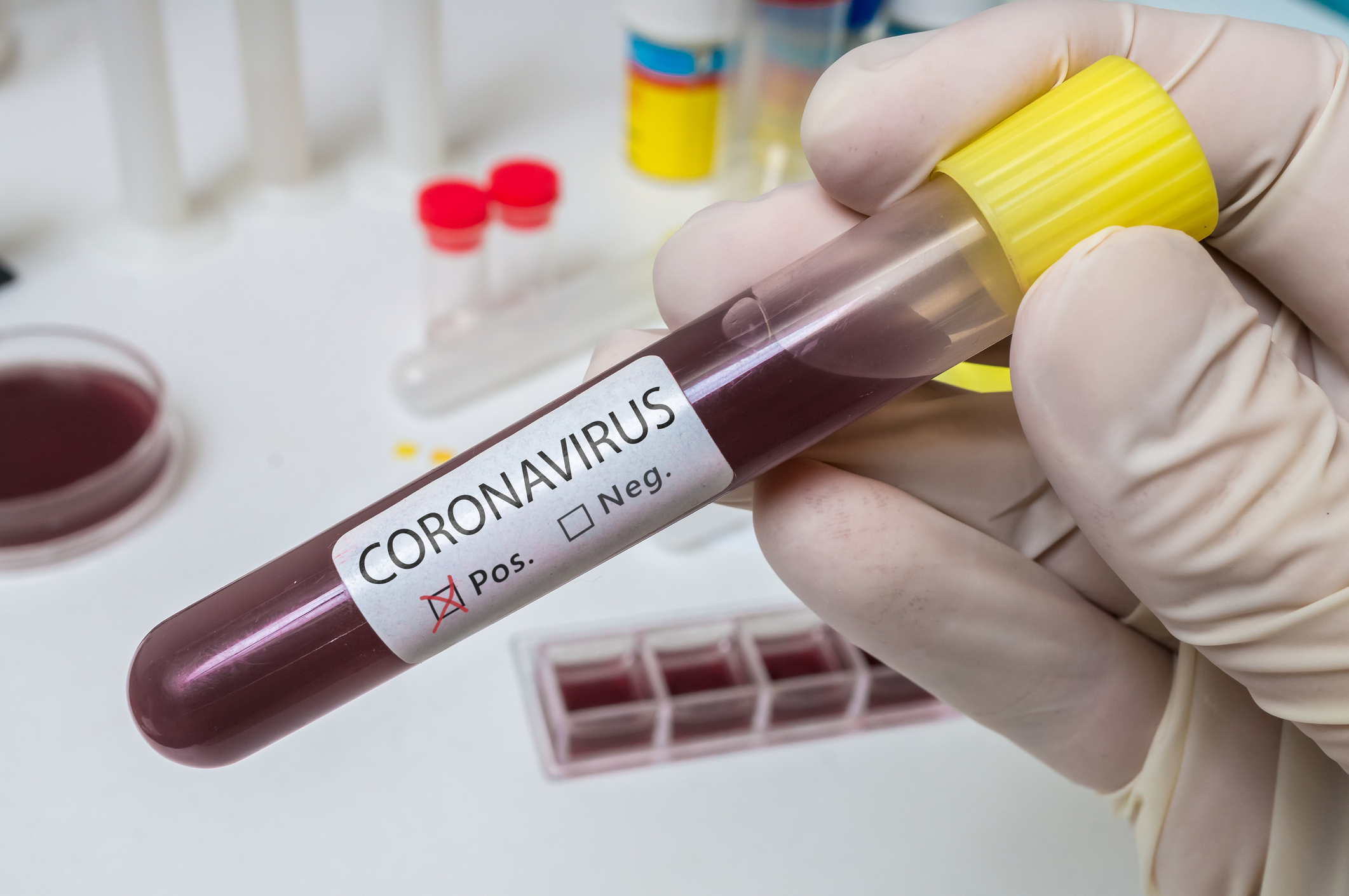 Coronavirus 115 People Test Positive In Hampshire In 24 Hours Daily Echo