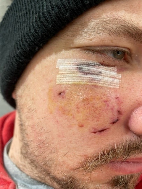 James Howard was badly bitten trying to defend his dog Rosie from another dog that attacked them in Pointout Road, Southampton.